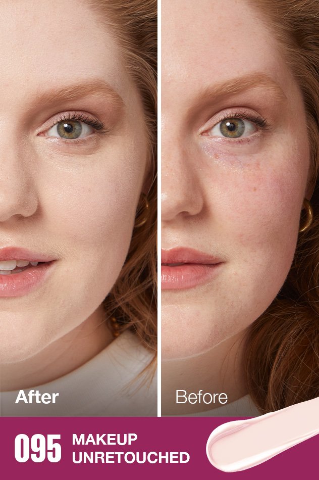 IARConcealer US BeforeAfter 095 632x950