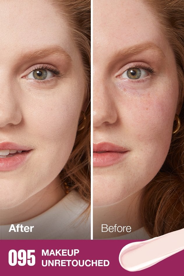 IARConcealer US BeforeAfter 095 632x950