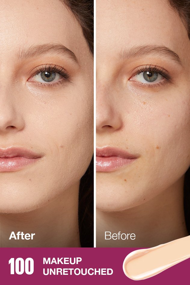 IARConcealer US BeforeAfter 100 632x950