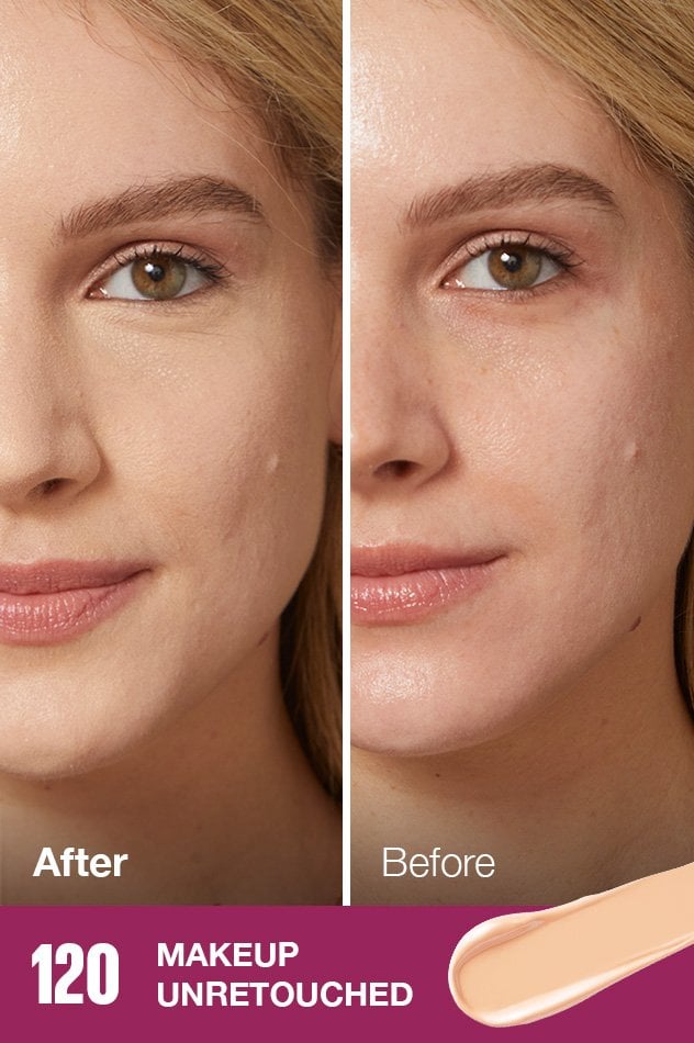 IARConcealer US BeforeAfter 120 632x950