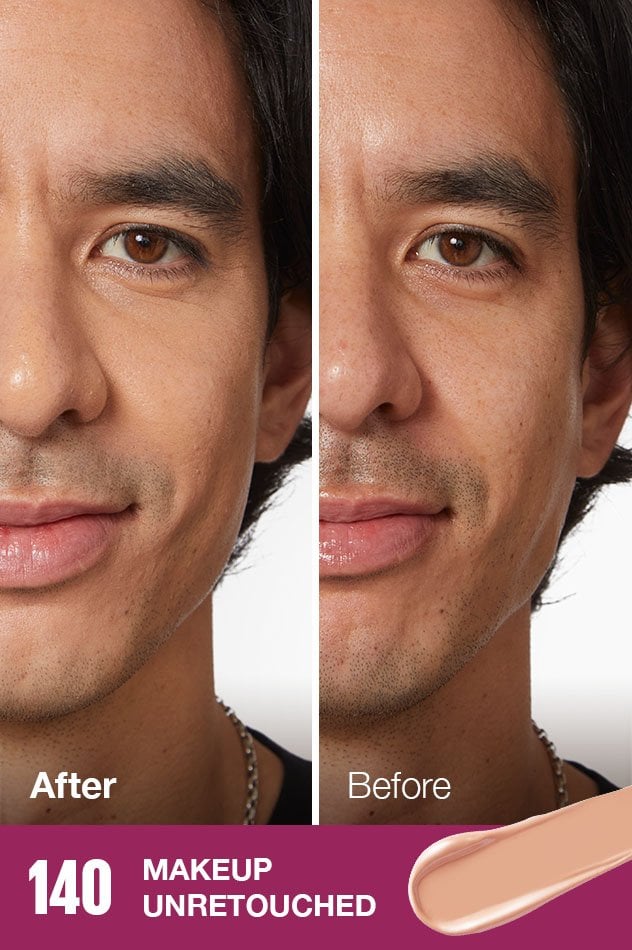 IARConcealer US BeforeAfter 140 632x950