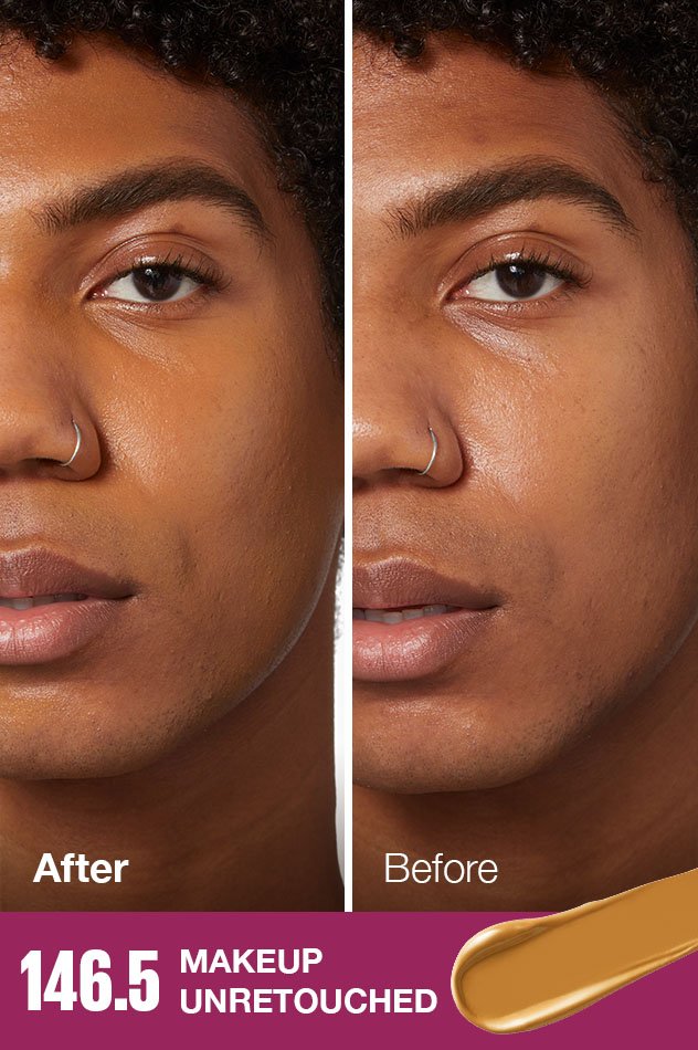 IARConcealer US BeforeAfter 1465 632x950