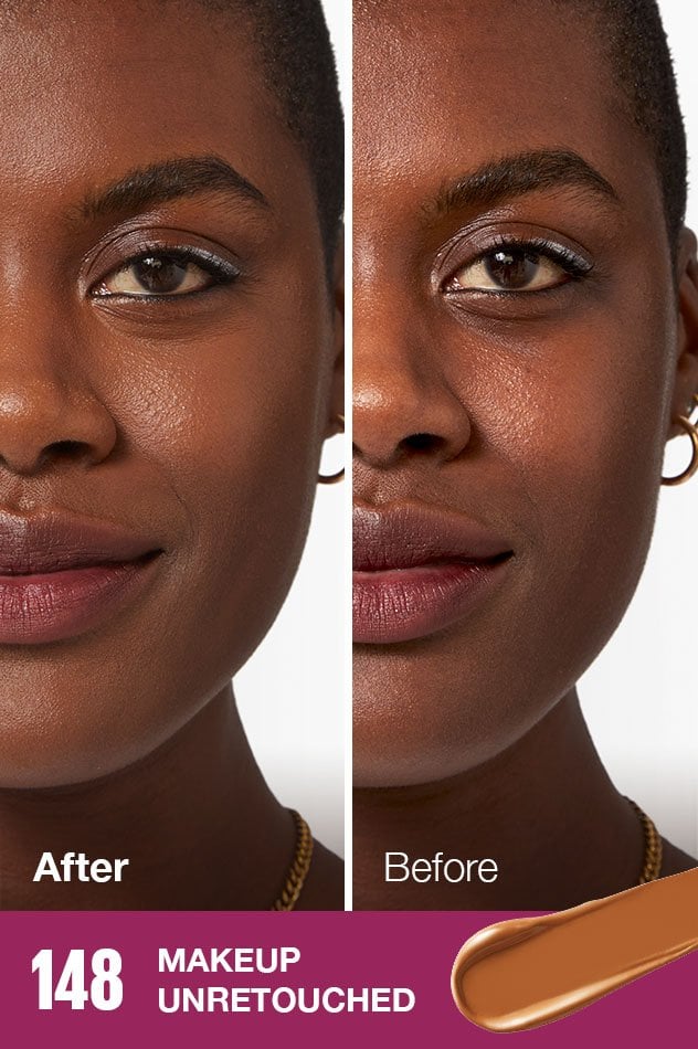 IARConcealer US BeforeAfter 148 632x950